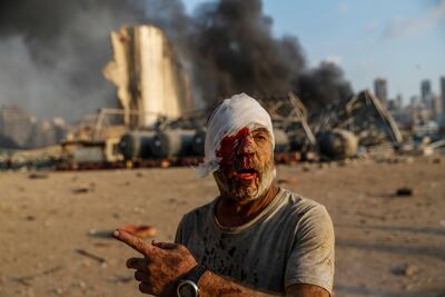 The port blast killed 200 people. AP