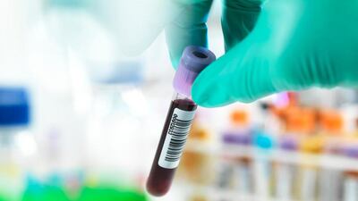 The experimental test has a false-positive rate of 0.5 per cent. Getty Images